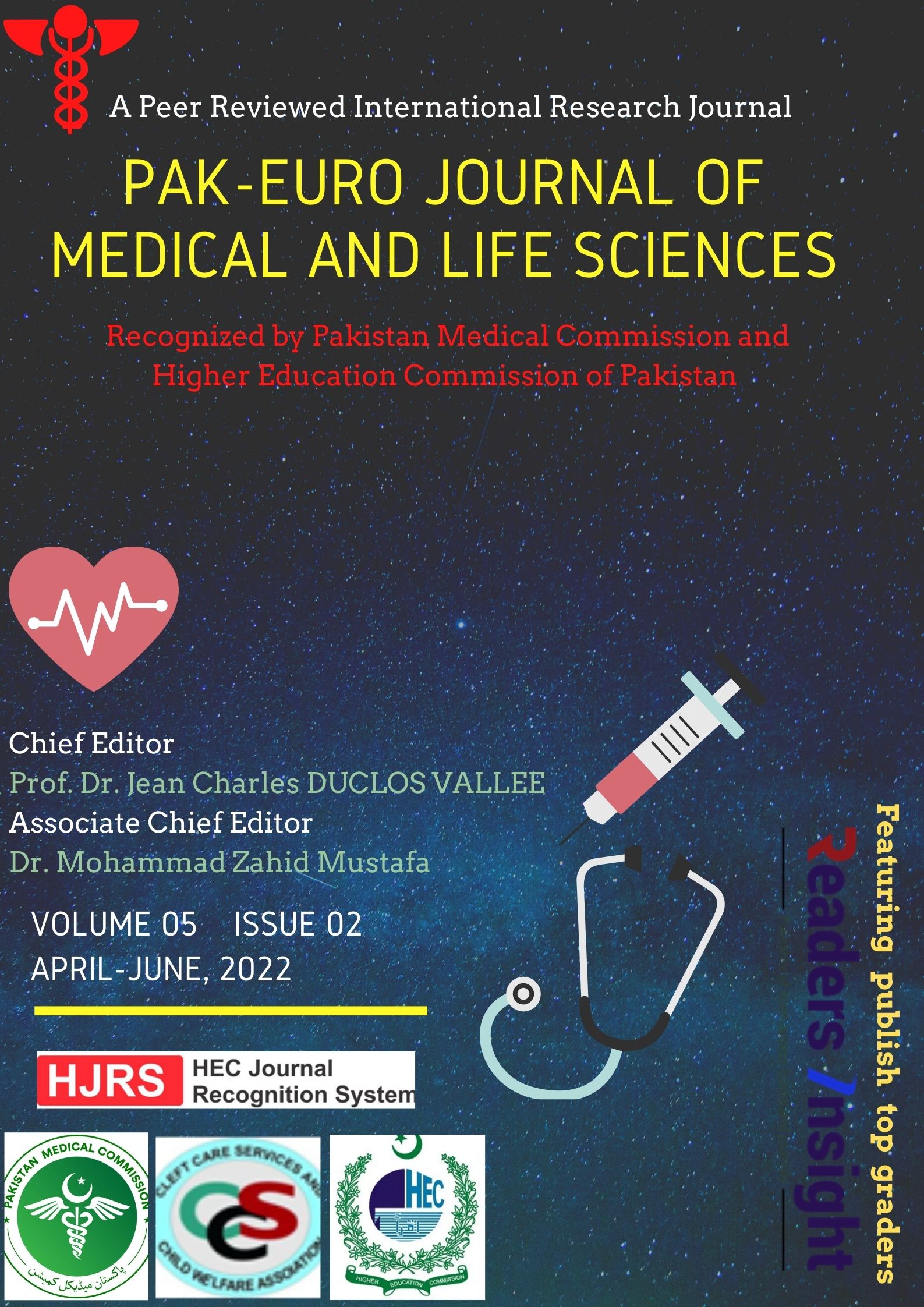 The Frequency Of Lymphocele And Its Management In Post Renal Transplant Patients In A Tertiary